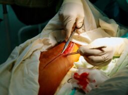 Orthopedic Surgery