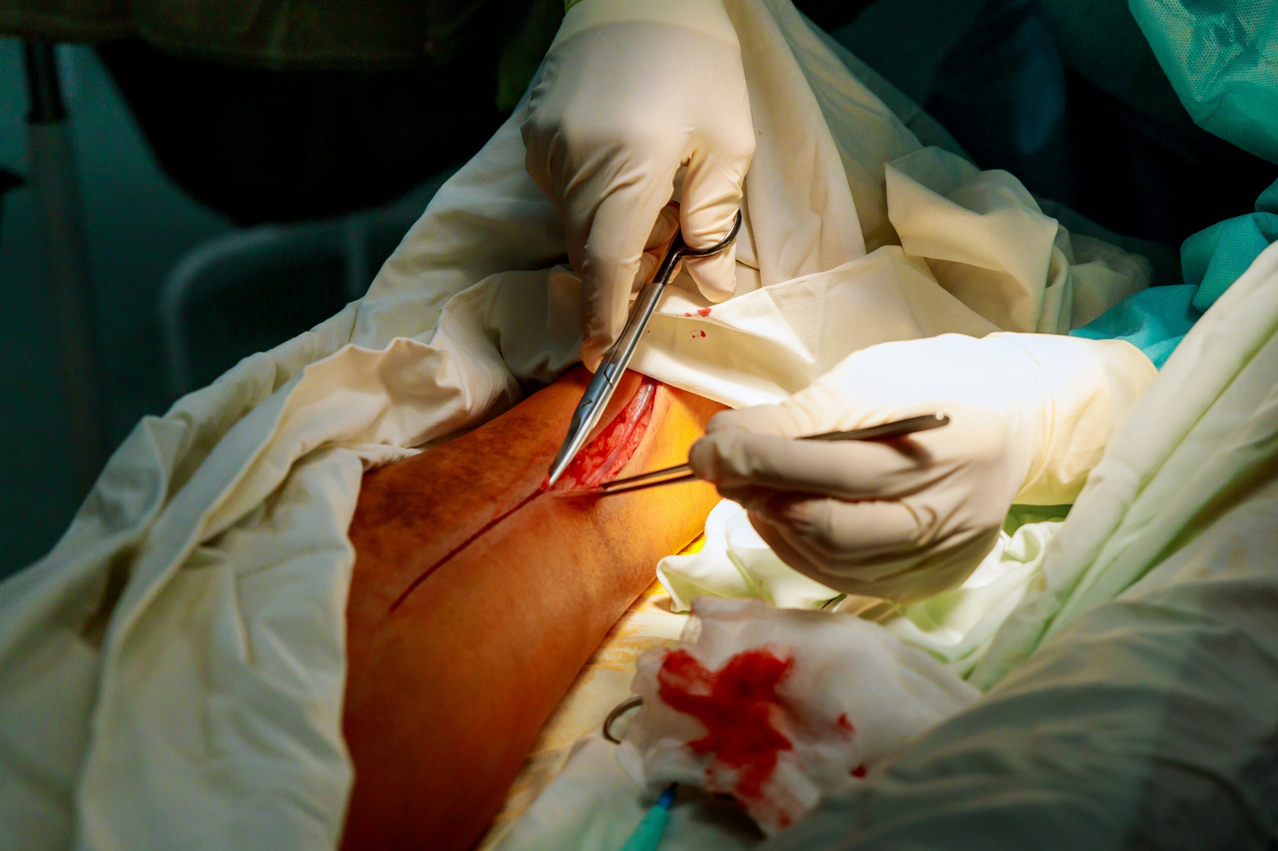 Orthopedic Surgery