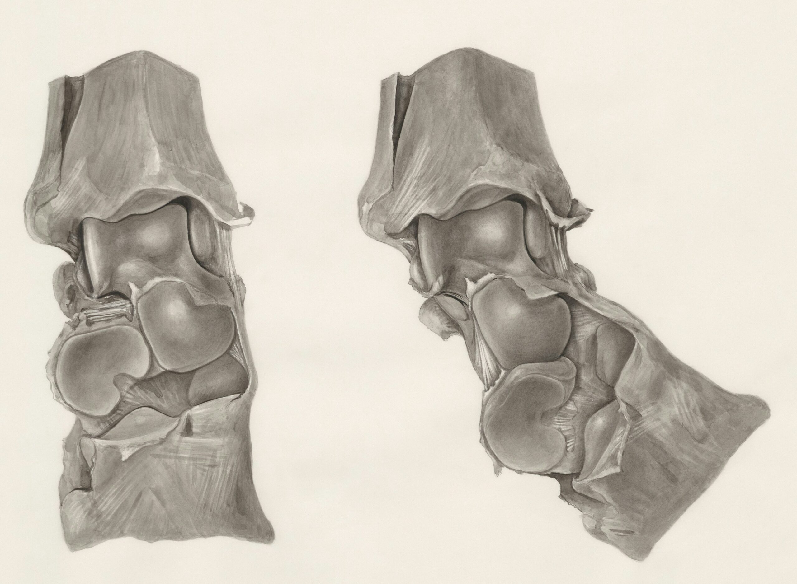 Orthopedic Implants